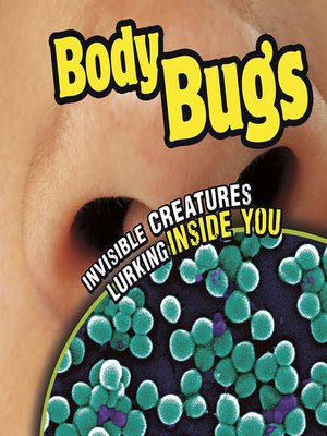 cover image of Body Bugs